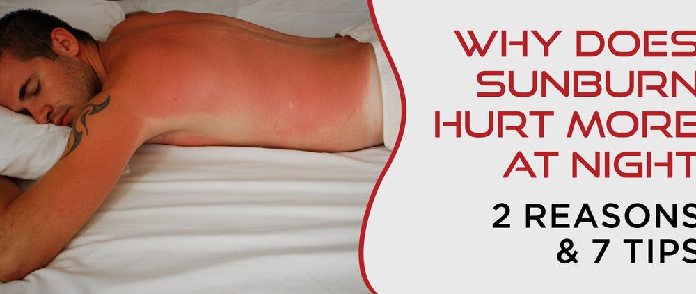 How To Sleep With Sunburn