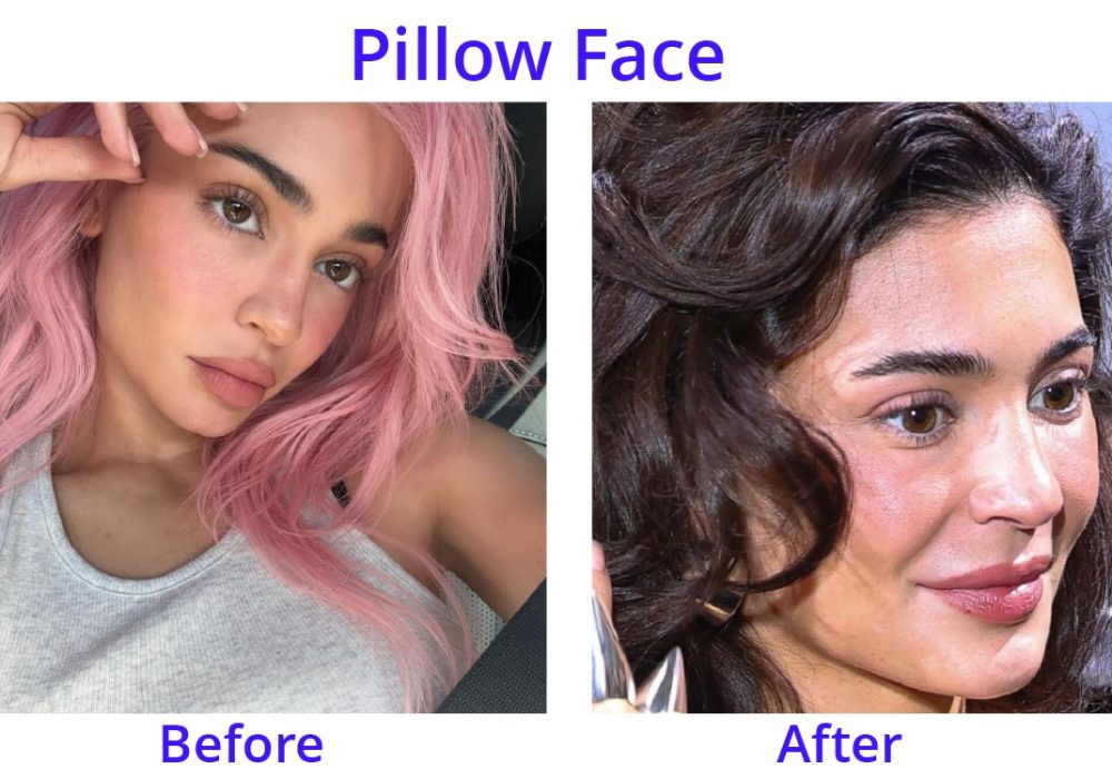 What is Pillow Face
